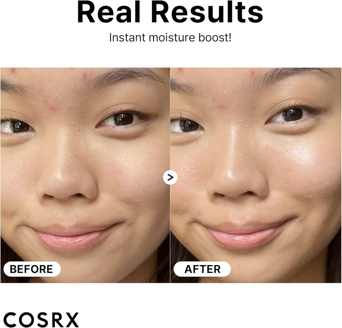 cosrx The Hyaluronic Acid 3 Serum, 20 ml