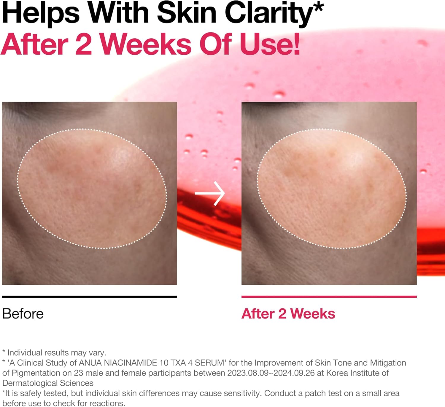 Anua Niacinamide 10% + TXA 4% Dark Spot Correcting Serum - Image 7