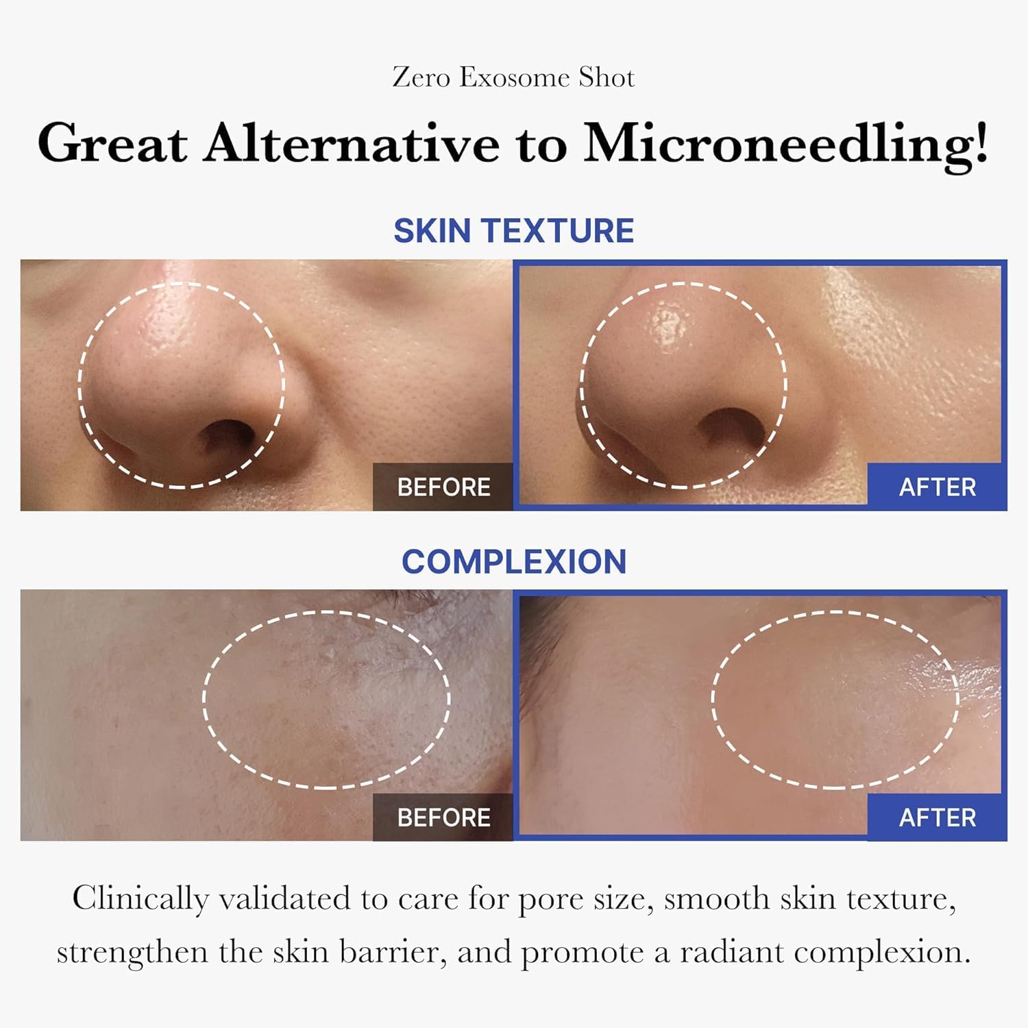 Medicube One Day Exosome Shot Pore Ampoule 2000 30mL - Image 5