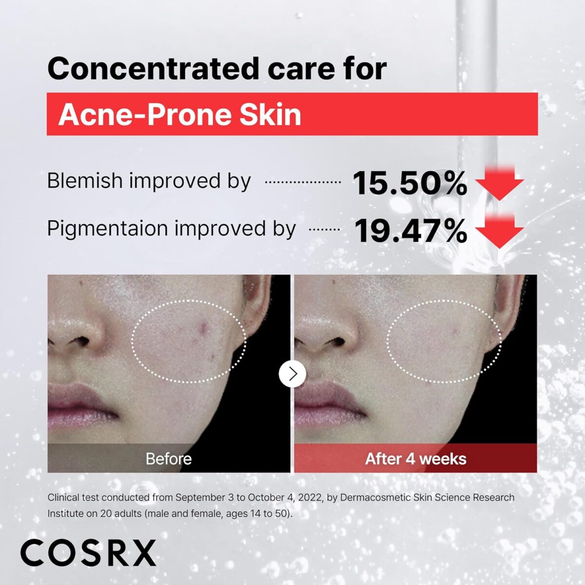 Cosrx The Niacinamide 15 Serum — Original Algérie